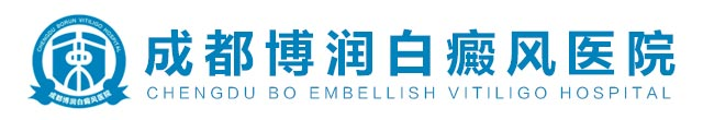 成都白癜风医院哪家好